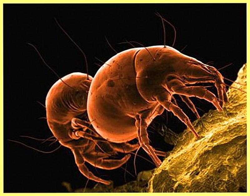 Зудневая чесотка фото